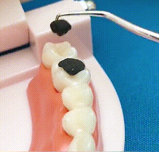 🦷Set de scobitori din oțel inoxidabil